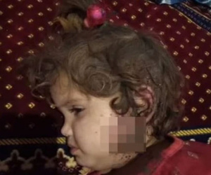 Cựu Bộ trưởng Afghanistan đăng hình ảnh tố Taliban giết hại trẻ em vô tội