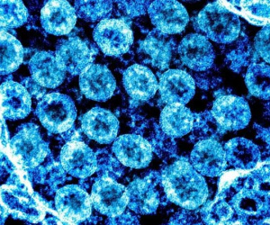 Phát hiện quan trọng về virus SARS-CoV-2 giúp phát triển thuốc chữa Covid-19