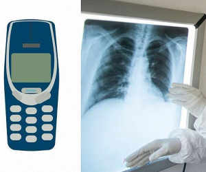 Bác sĩ nội soi lấy điện thoại di động ra khỏi bụng tù nhân