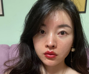 Làn da xuất hiện 5 dấu hiệu này thì chứng tỏ bạn đang bị kích ứng với mỹ phẩm đang dùng