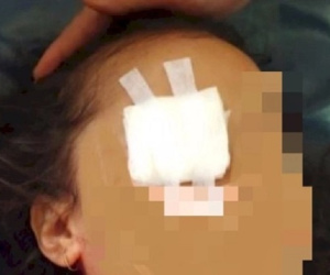 Rúng động: Bé gái bị cha mẹ đẻ khoét mắt 'làm lễ' cầu tài lộc, cảnh sát điều tra phát hiện chuyện man rợ