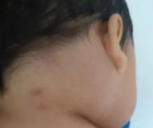 Con trai bị côn trùng cắn lúc ngủ, bố mẹ 'chết lặng' khi bác sĩ báo tin con tử vong để lại bí ẩn chưa ai giải thích được