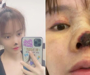 Hot girl bị rụng mũi khiến dân Trung Quốc 'nổi điên': Điều phẫn nộ nhất lại nằm ở bản án 'không tin nổi'
