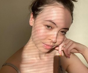 Sự thật: Retinol có thể gây kích ứng gấp đôi vào mùa hanh khô?