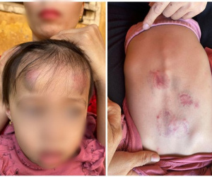 Vụ bé gái 2 tuổi bị bạn học đánh đạp dã man: Lãnh đạo xã khẳng định sẽ đóng cửa cơ sở nếu có sai phạm, chia sẻ về tình hình hiện tại của cháu bé
