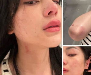 Lily Chen tung loạt ảnh bị hành hung, tiết lộ ai đó đặt chuyện hãm hại giữa drama với 'nữ hoàng nội y'?