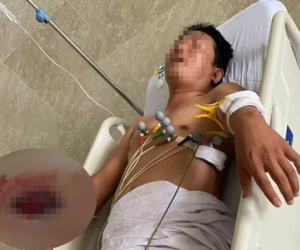 Người đàn ông ở Củ Chi bị bắn 4 phát sau khi thách đối phương 'bắn đi'