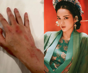 Karik đăng bàn tay đầy máu giữa lúc vướng nghi ngờ hẹn hò, phản ứng của Quỳnh Lương càng bất ngờ hơn