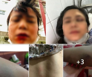 Lấy chồng 8 năm bị lừa sạch tài sản, vợ đòi nói chuyện phải trái thì chồng chạy đến tận nhà ngoại đánh đến nhập viện, khủng khiếp nhất là tin nhắn tiết lộ bí mật của tiểu tam