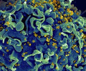 Lại thêm người tự khỏi HIV một cách bí ẩn