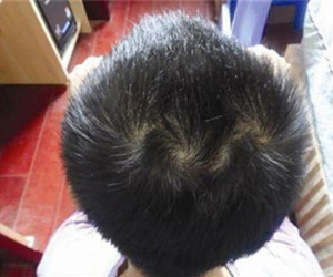Đếm xoáy tóc đọc vị tương lai cực chuẩn mỗi người