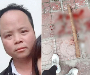 Đánh tình địch chấn thương sọ não, nát 2 chân ngay trên đường phố Hà Nội