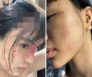Công an vào cuộc điều tra, đưa siêu mẫu Khả Trang đi giám định thương tích