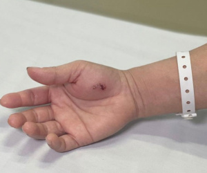 Người phụ nữ Hà Nội nhiễm độc phải cấp cứu vì lý do khiến bác sĩ cũng... ngỡ ngàng