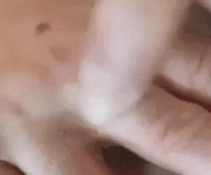 Sự thật về chứng 'lông hóa' đe dọa hàng loạt thợ cắt tóc gây xôn xao Tiktok