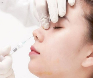 Cô gái hoại tử da mặt sau khi tiêm filler nâng mũi tại một cơ sở làm đẹp