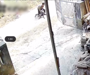 Vụ bé trai 2 tuổi bị chó dữ tấn công kinh hoàng: Trên cơ thể có nhiều vết thương, phẫu thuật gấp