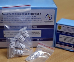 Giá kit xét nghiệm Covid-19 của Công ty Việt Á được bán bao nhiêu?
