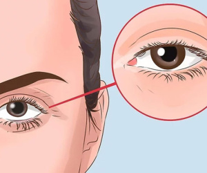 Dấu hiệu trên mặt cảnh báo thận bất ổn