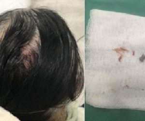 Nữ công nhân nghi bị đạn súng hơi bắn vào đầu khi đang chăm sóc cây xanh