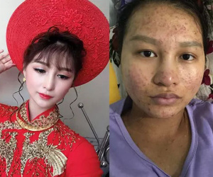Xịt máu mũi với 'chồng người ta' gửi vợ mỗi lần trăm triệu tiêu vặt