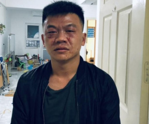 Nghi án 3 đối tượng xông vào căn hộ chung cư ở Hà Nội xịt hơi cay, trói chủ nhà để cướp