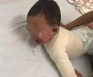 Cấp cứu bé gái bị bỏng nước sôi, bác sĩ phát hiện chi tiết lạ liền báo cảnh sát bắt giữ ngay người phụ nữ trẻ đưa bé đến bệnh viện