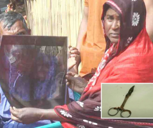 Người phụ nữ Bangladesh 20 năm sống chung với cây kéo bị bỏ quên trong bụng