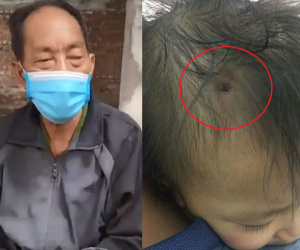 Clip: Chia sẻ mới nhất của ông nội về tình hình bé gái bị đóng đinh vào đầu