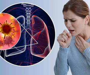 Dấu hiệu của ung thư phổi thể hiện trên mặt vào buổi sáng