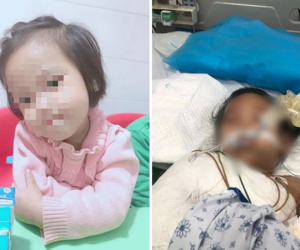 Bé gái 3 tuổi bị đinh cắm vào đầu đã qua cơn nguy kịch, có phản xạ tay chân