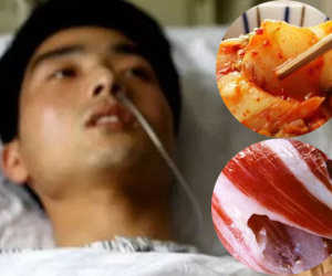 Chàng trai 29 tuổi mắc ung thư dạ dày giai đoạn cuối, hối hận vì 'nghiện' 2 loại thực phẩm mà nhiều người yêu thích