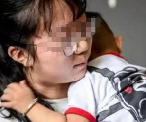 Bé trai 3 tuổi ăn nhầm hạt hút ẩm, mẹ bình tĩnh ứng phó cứu sống con, bác sĩ cũng dành lời khen