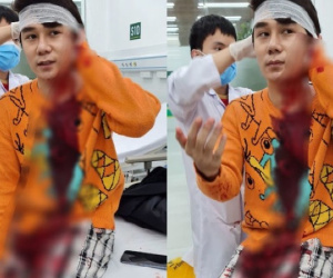Nam diễn viên phim 'Thương ngày nắng về' bị chém trọng thương