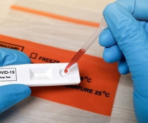 7 biến chứng kéo dài hậu COVID-19 và cách khắc phục