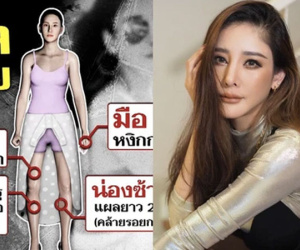 NÓNG: Công bố chi tiết về loạt vết thương trên thi thể nữ diễn viên 'Chiếc Lá Cuốn Bay', cô bạn thân sẽ bị khởi tố?