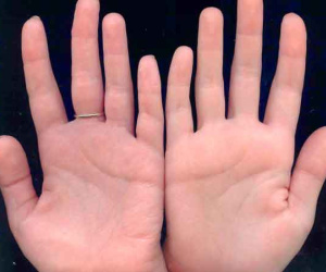 Xem tướng bàn tay biết ngay mức độ giàu sang hay khốn khó