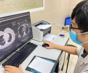 Một bệnh nhân tử vong nghi do di chứng Covid-19