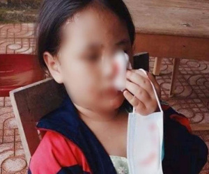 Xôn xao hình ảnh bé gái 8 tuổi ôm mũi, máu chảy ướt áo sau khi lấy mẫu test nhanh COVID-19