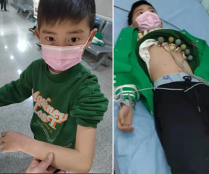 Bé trai vượt hơn 400km, chấp nhận đau đớn để bác sĩ lấy 30 ống máu cứu mẹ