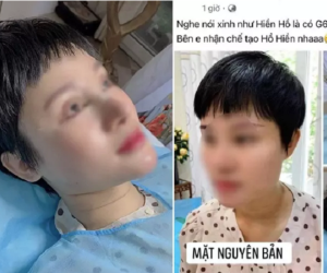 Sốt xình xịch với hình ảnh cô gái quyết tâm phẫu thuật giống Hiền Hồ để có chiếc G63