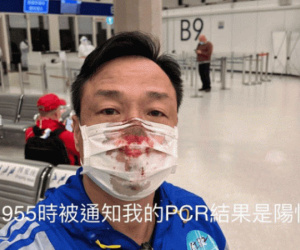 Sao Hong Kong 54 tuổi chảy máu mũi đầm đìa vì bị chọc dụng cụ quá mạnh khi đi test Covid-19