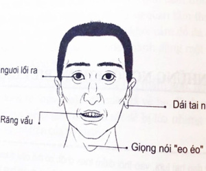 4 nét tướng đàn ông lắm điều nhiều chuyện, dễ gây thị phi khiến ai cũng không ưa