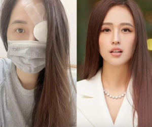 Sau hình ảnh băng bó mắt, Mai Phương Thúy lên tiếng trấn an mọi người và tiết lộ sức khỏe ở thì hiện tại