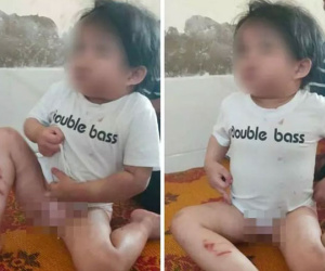 Bé gái 4 tuổi bị dì ruột dùng cán chổi, móc áo đánh đập trong 3 ngày