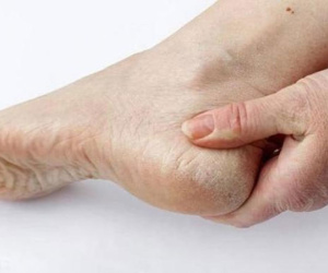 Gan có tốt hay không là do bàn chân 'biết trước', nếu bàn chân gửi 4 'tín hiệu' này, đừng bất cẩn