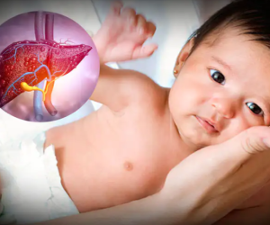 Việt Nam chưa ghi nhận trẻ mắc viêm gan cấp tính bí ẩn