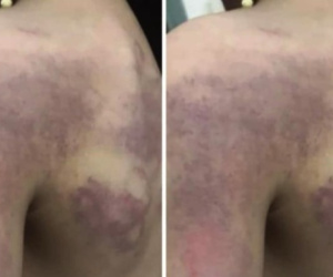 Cô giáo đánh học sinh do không làm được bài: Giám đốc Sở nói gì?