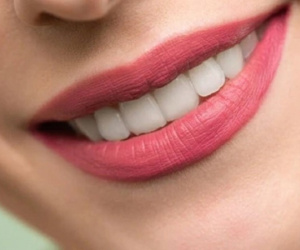 Những sai lầm phổ biến trong mùa hè có thể làm hỏng răng của bạn