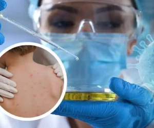 Nước đầu tiên trên thế giới áp dụng cách ly bắt buộc phòng ngừa bệnh đang khiến giới chuyên gia lo ngại